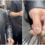 黃仁勳「指甲顏色」吸115萬人關注　他酸身價千億也灰指甲被打臉！皮膚科醫揭真相